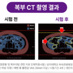 쉬안 복부마사지기 온열 진동 지압 장운동 관리기 SA-2000 상품 이미지 6